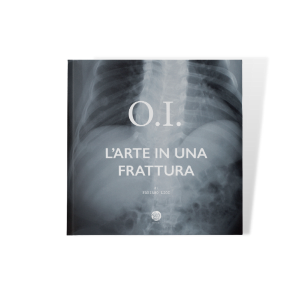L'Arte-in-una-frattura-O.I. Fabiano Lioi Arte frattura